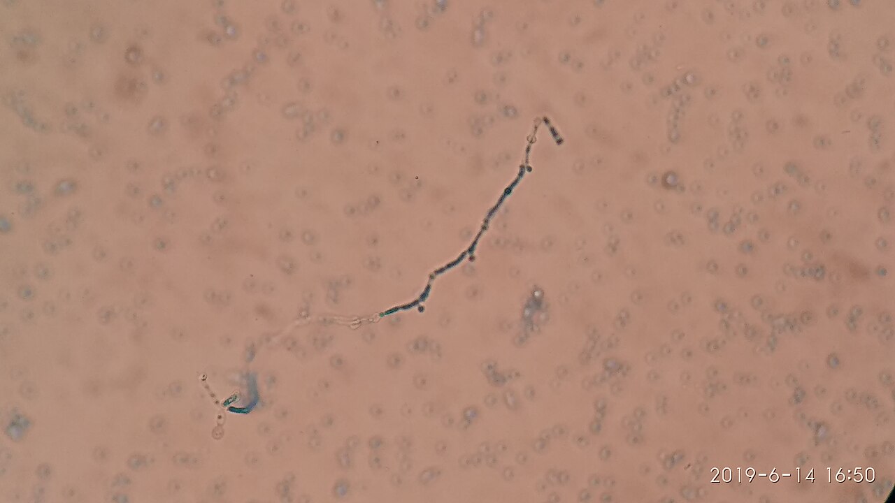 Chlamydospore of Candida albicans in LPCB preparation — Le champignon qui sonne à notre porte cellulaire