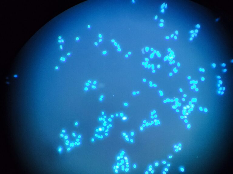 Fluorescence microscopy of the DNA of the oral cancer cells — Biotin: le pass métabolique que le cancer nous vole