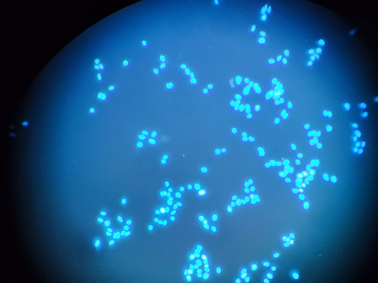 Fluorescence microscopy of the DNA of the oral cancer cells — Biotin: le pass métabolique que le cancer nous vole