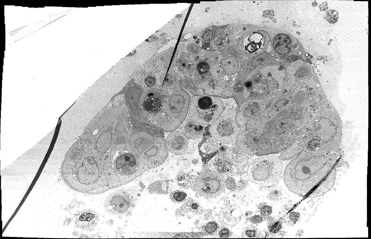 Image Data Resource - idr0083 - 9822152 — Le virus de la diarrhée porcine recrute nos lipides
