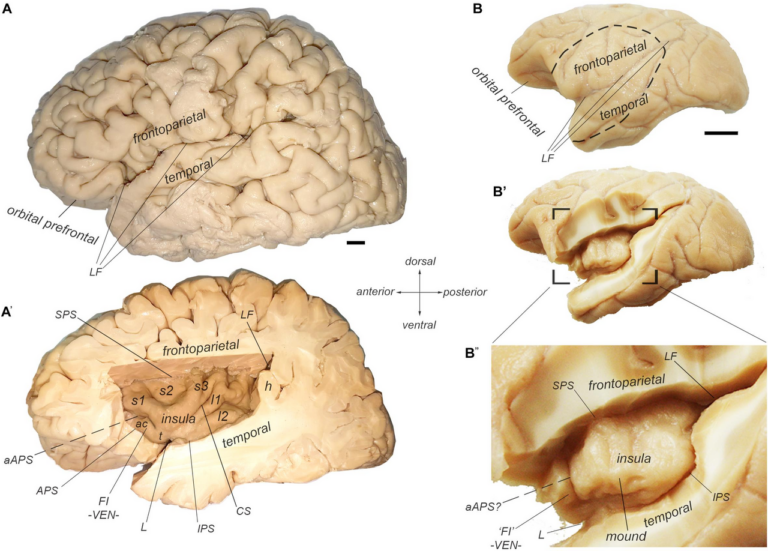 Insula of human and cynomolgus macaque monkey — Votre cerveau classe le temps. Nous, on s'adapte.