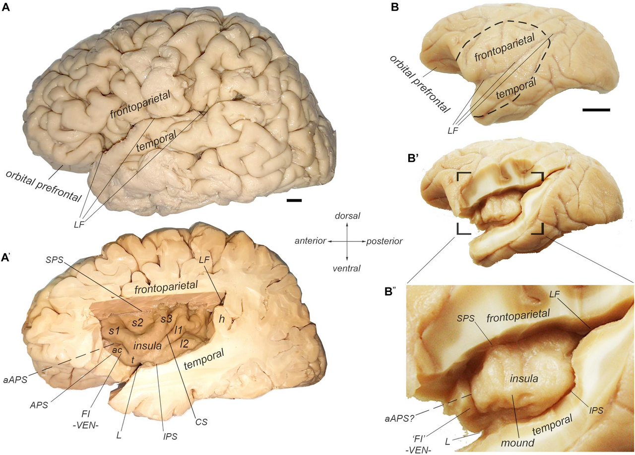 Insula of human and cynomolgus macaque monkey — Votre cerveau classe le temps. Nous, on s'adapte.
