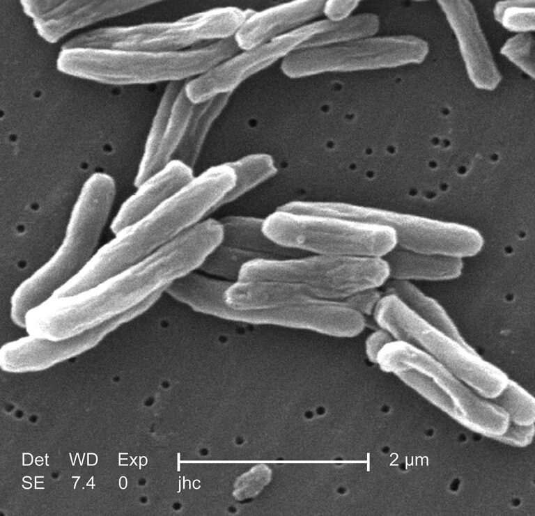 Mycobacterium tuberculosis — Stress cellulaire: nos secrets, leurs découvertes
