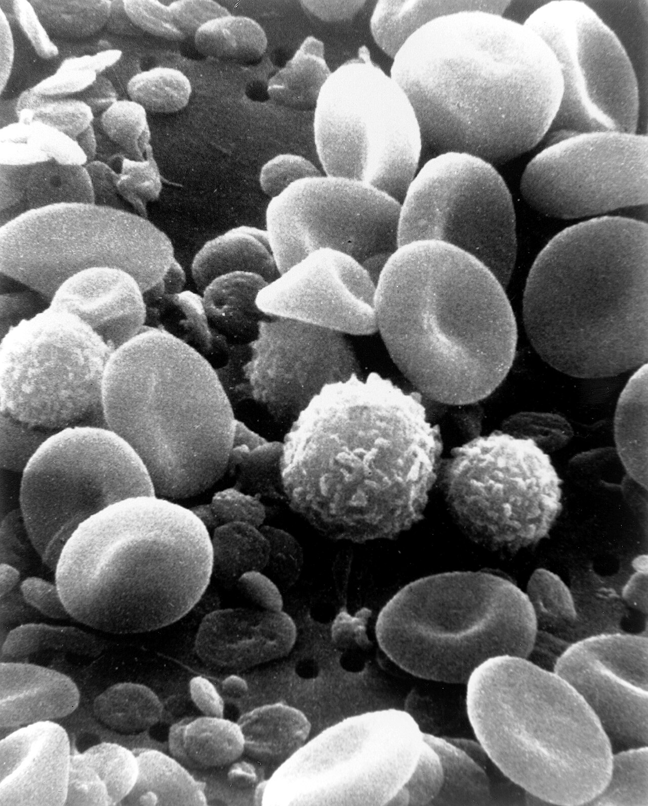 SEM blood cells — Bébés et virus: quand les CD8 jouent les absents