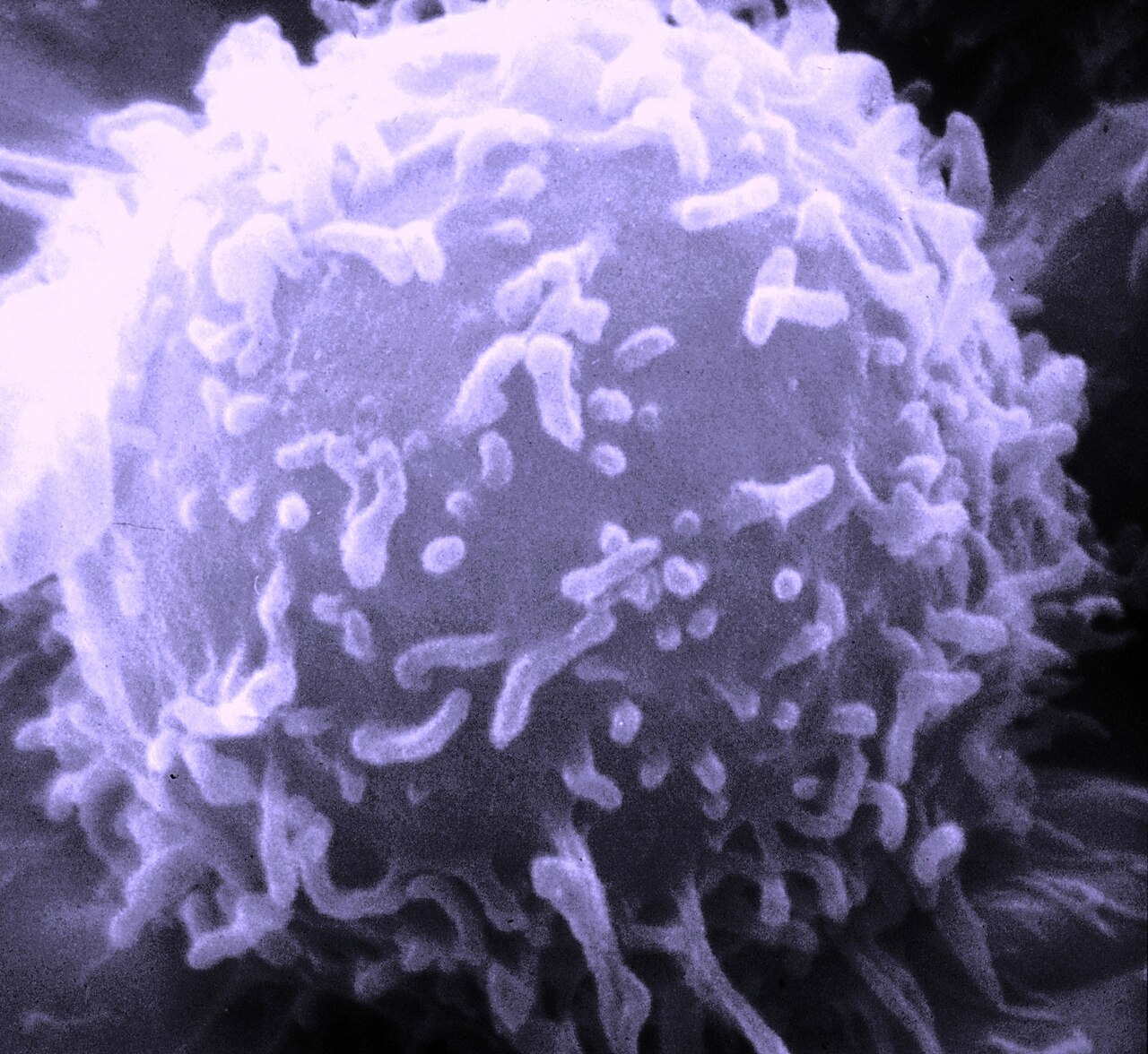 SEM Lymphocyte immune cell — Ce virus qui vole notre sucre pour se multiplier